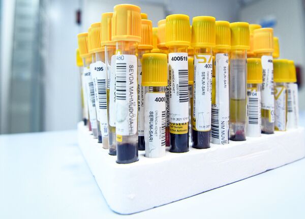 Пробирки с биоматериалом для проведения ПЦР-тестов на коронавирус
