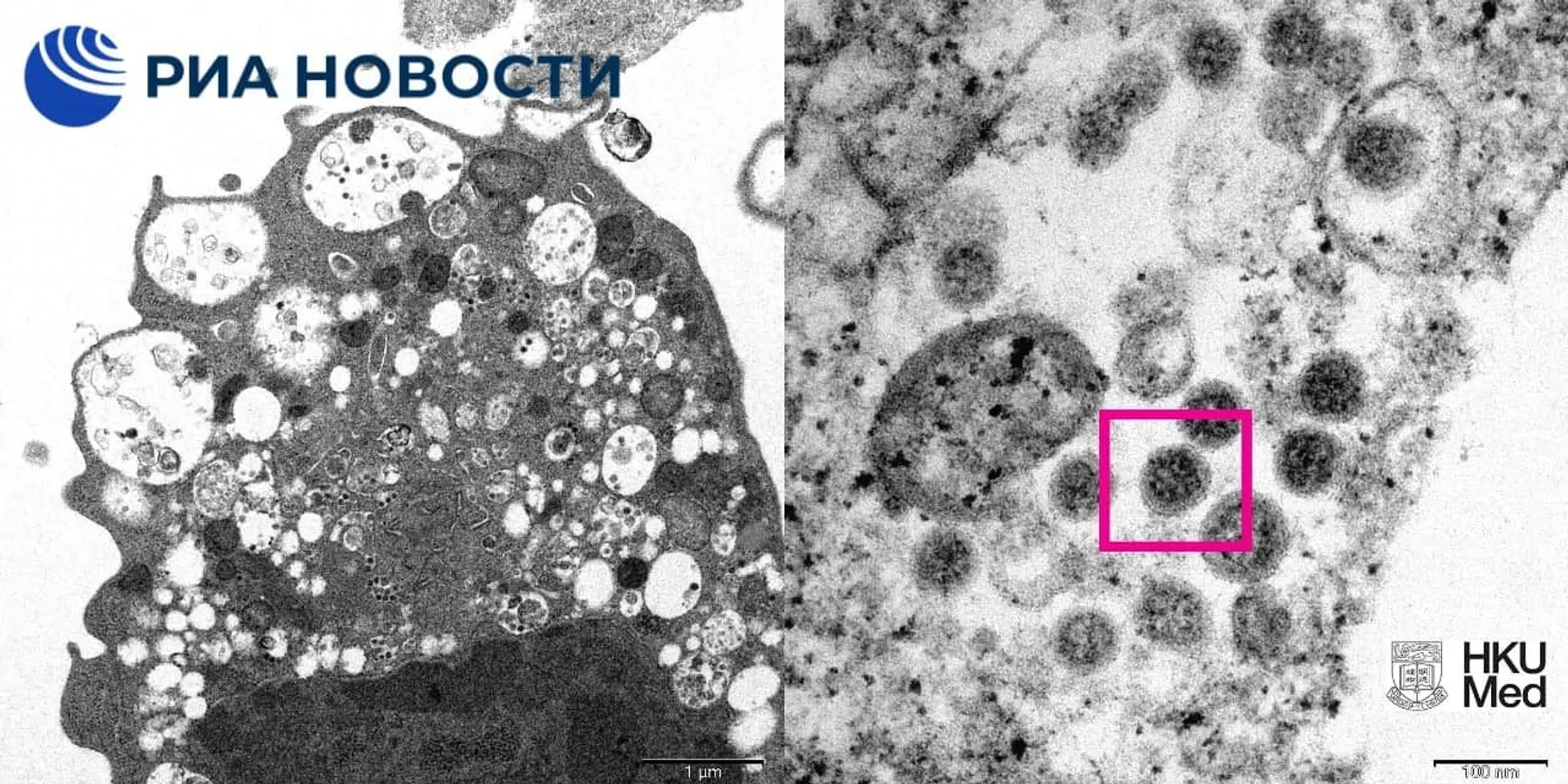 Новый штамм COVID-19 омикрон - ПРАЙМ, 1920, 18.12.2021